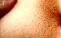 hairy webcam